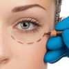 surgery-img