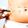 surgery-img